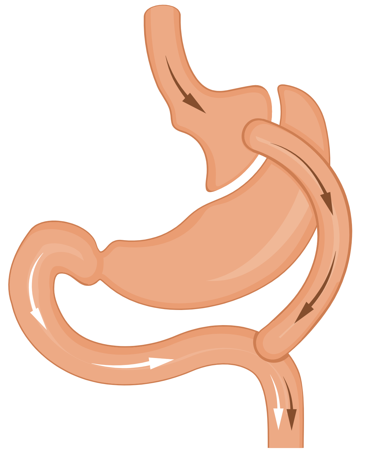 Gastric Bypass icon