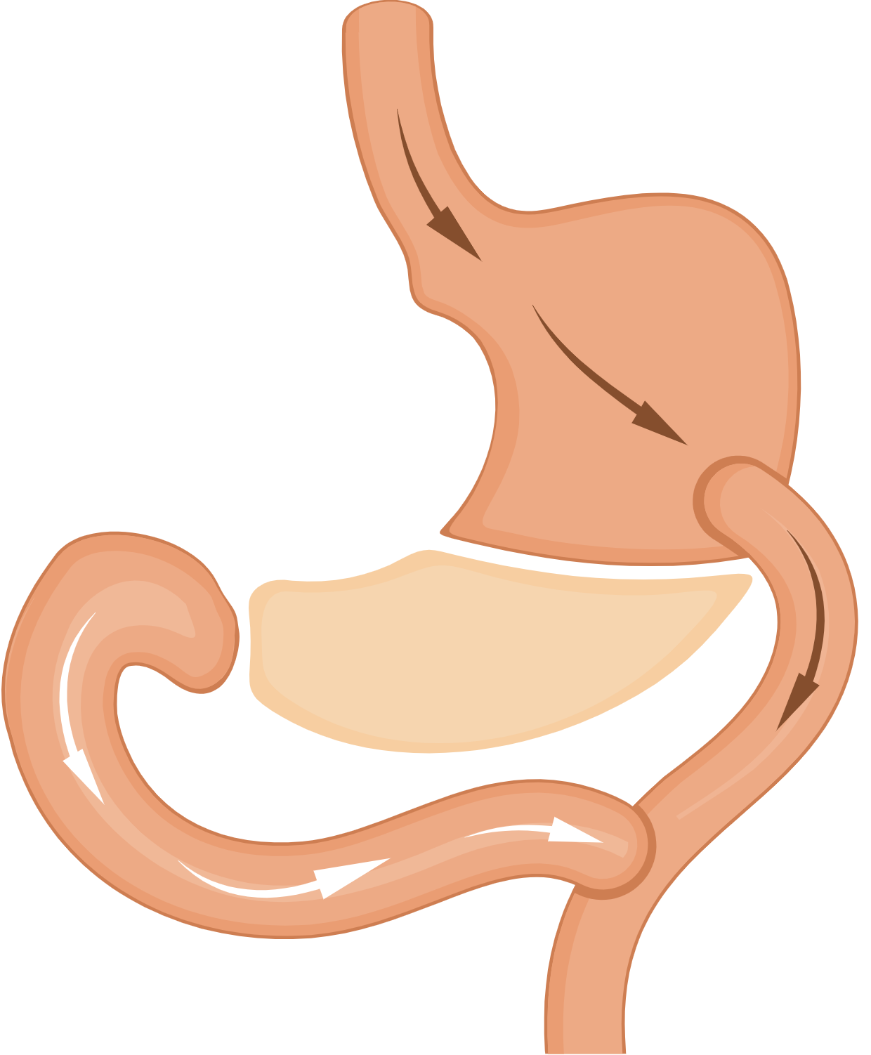 Revision Bariatric Surgery icon